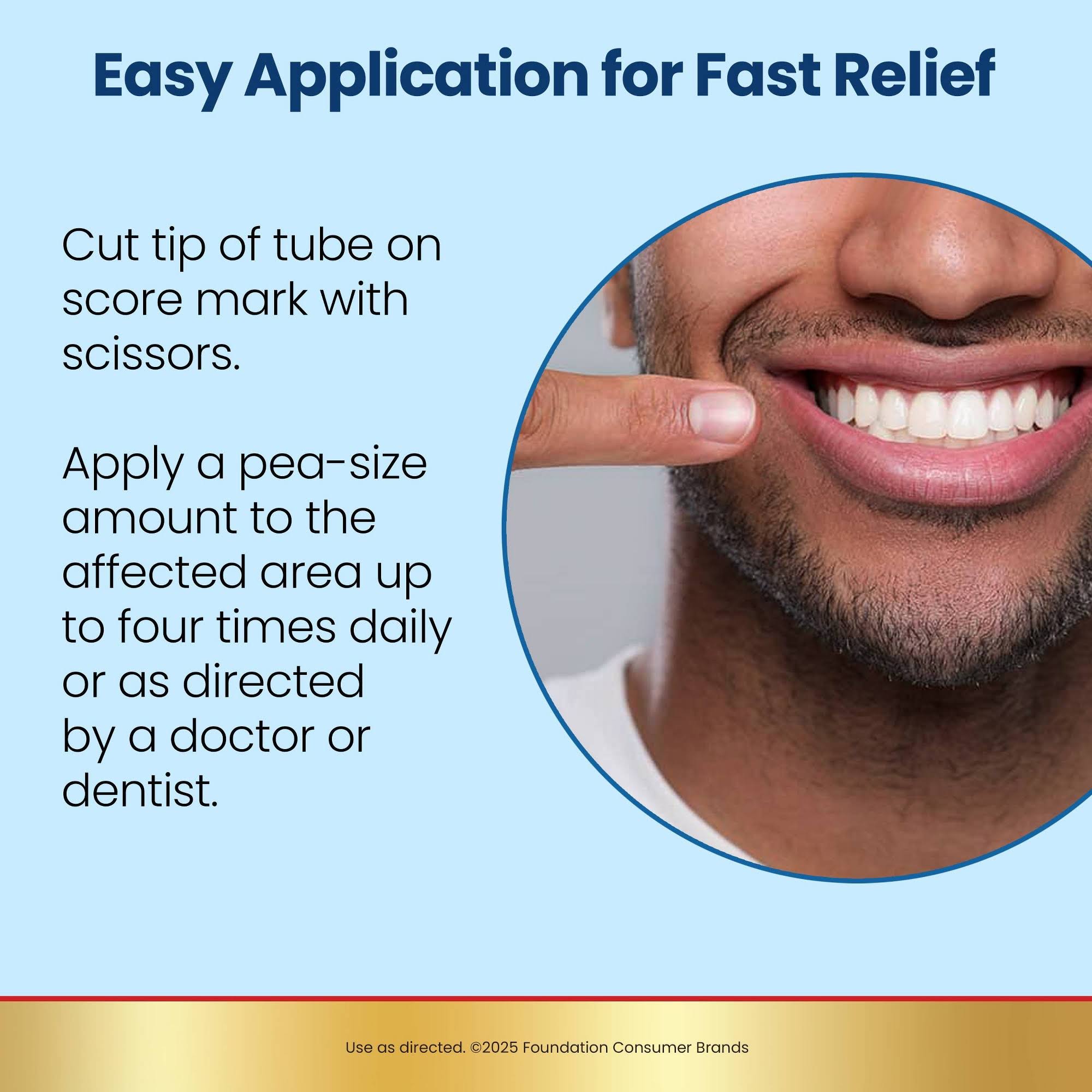 Anbesol Gel Maximum Strength Instant Oral Pain Relief - 0.33oz